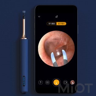 Розумна вушна паличка Xiaomi Bebird Ear Picker Note3 Blue