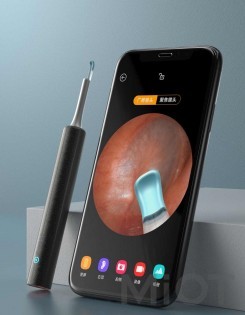 Розумна вушна паличка Xiaomi Bebird Ear Picker T5 Black