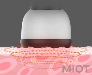 Вібромасажер Xiaomi Left Point Meteorite Health Scraper ZD-GS326