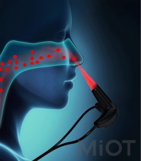 Портативний пристрій для лікування риніту Xiaomi Zdeer Semiconductor Laser Therapy KJR-JGXY-A 