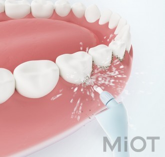 Іригатор для ротової порожнини Xiaomi SUNUO Smart Teeth Device C3 Pro White